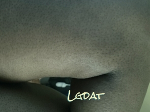 Lgdat